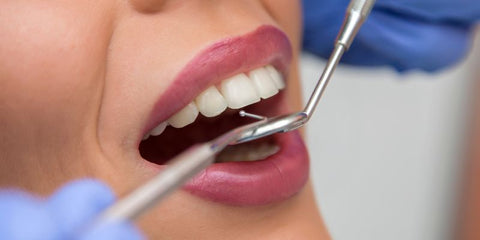 découvrez les avantages du détartrage dentaire à avignon pour une meilleure hygiène bucco-dentaire, prévenir les maladies des gencives et garder un sourire éclatant.