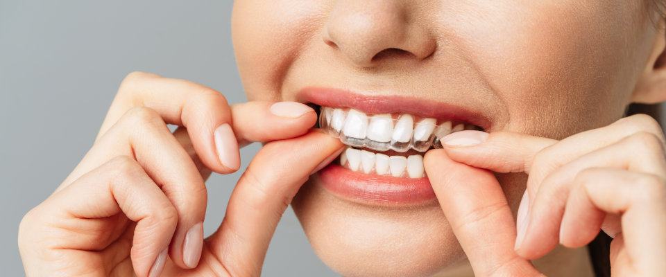 trouvez un dentiste spécialisé à avignon pour le traitement efficace des aphtes. soins professionnels pour soulager rapidement l'inconfort.