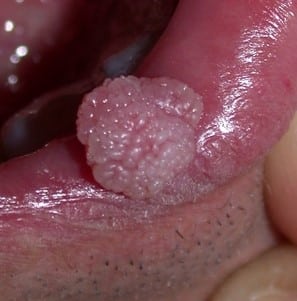 découvrez à avignon les solutions spécialisées pour la prise en charge buccale des maladies chroniques, alliant expertise et soins personnalisés pour votre santé dentaire.