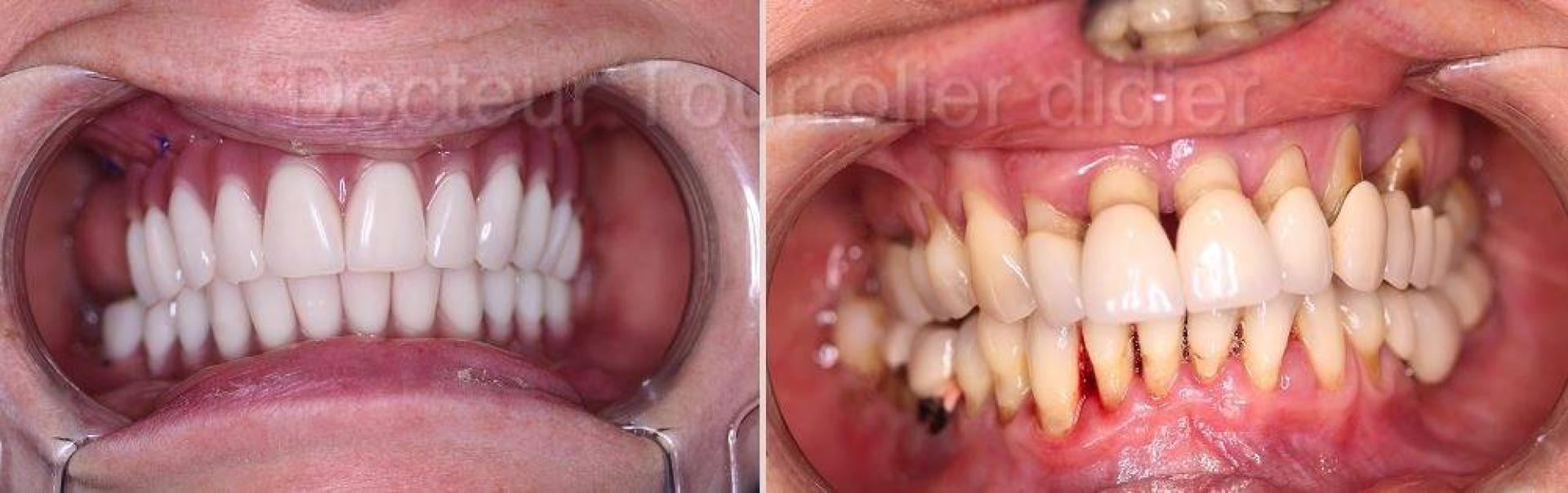 découvrez notre consultation esthétique dentaire à avignon pour un sourire éclatant et harmonieux. expertise, confort et innovaton au service de votre beauté dentaire.