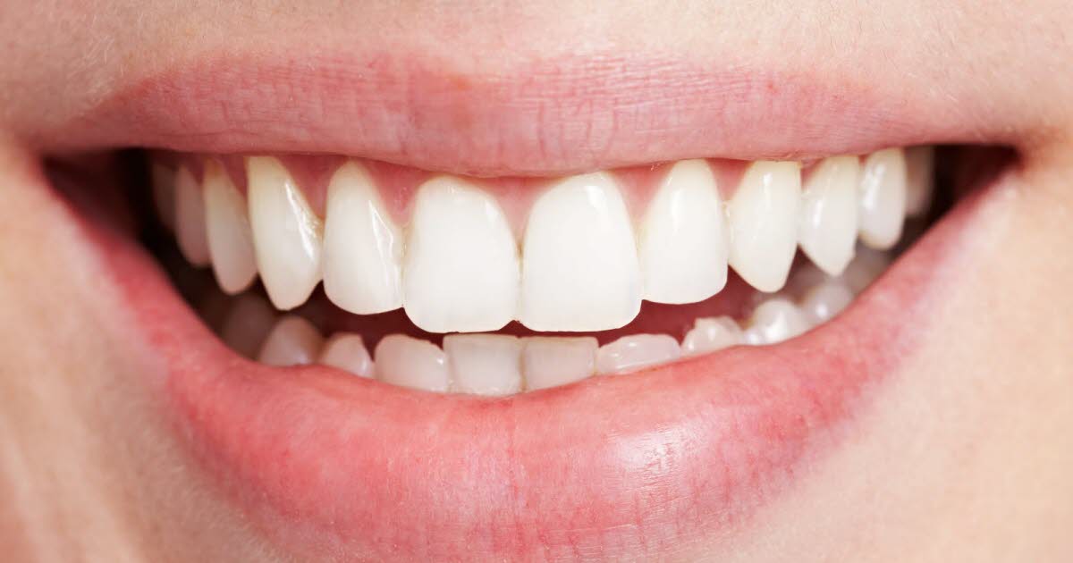 découvrez un dentiste à avignon spécialisé en soins esthétiques du sourire pour retrouver confiance et éclat naturel.