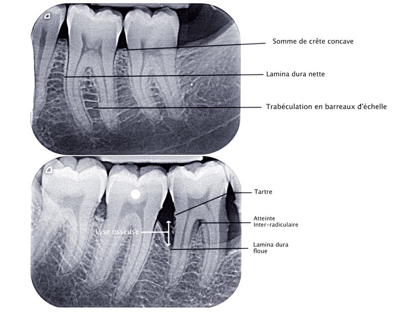 découvrez les avantages de la radiographie numérique chez un dentiste à avignon : diagnostic précis, rapidité, sécurité et confort pour des soins dentaires optimaux.