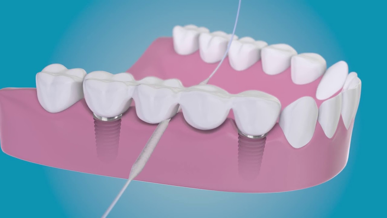 découvrez les conseils essentiels d'un dentiste à avignon pour une hygiène buccale optimale et un sourire sain au quotidien.