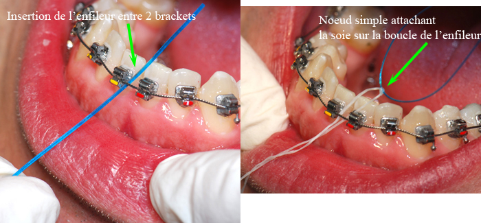 découvrez des conseils adaptés à chaque âge pour une hygiène buccale optimale avec votre dentiste à avignon. prenez soin de votre sourire tout au long de la vie.
