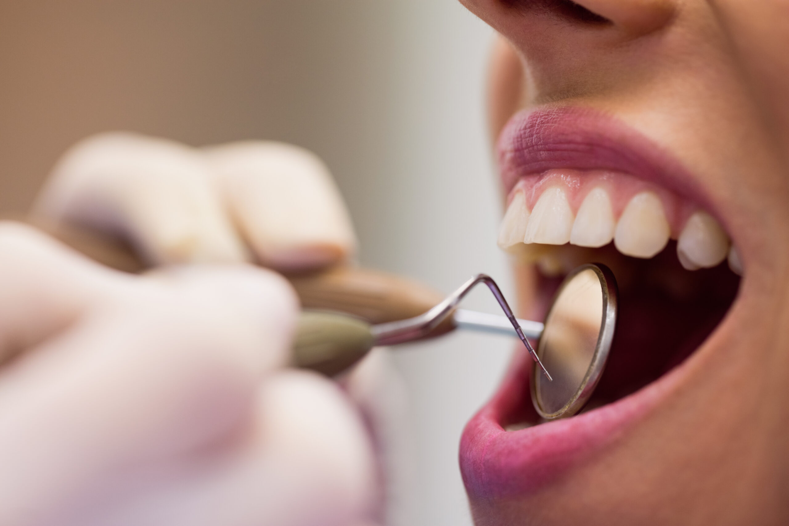 découvrez les conseils et soins de prévention bucco-dentaire avec votre dentiste à avignon pour garder un sourire sain et éclatant.
