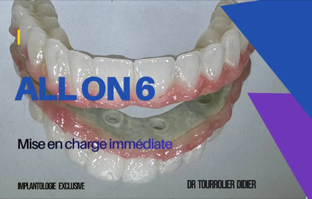 découvrez les réponses aux questions fréquentes lors de votre première visite chez le dentiste à avignon pour une expérience sereine et informée.