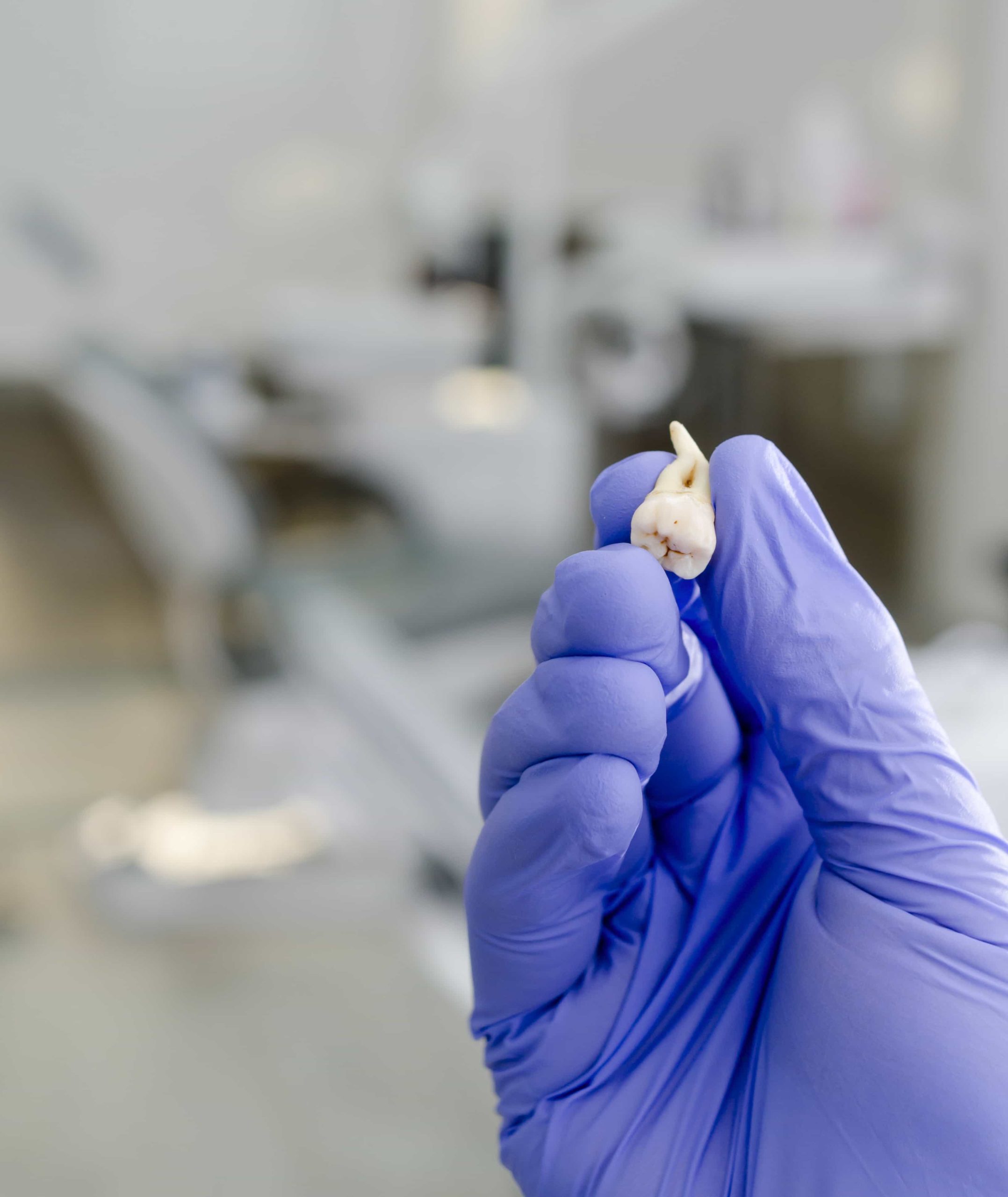découvrez notre service d'extraction dentaire à avignon, alliant expertise et récupération douce pour un confort optimal.