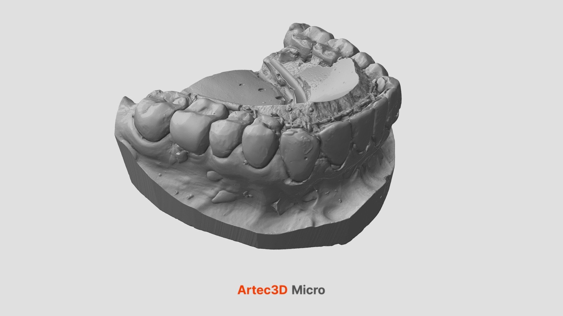 découvrez le fonctionnement des scanners 3d utilisés par les dentistes à avignon pour des diagnostics précis et des soins dentaires innovants.