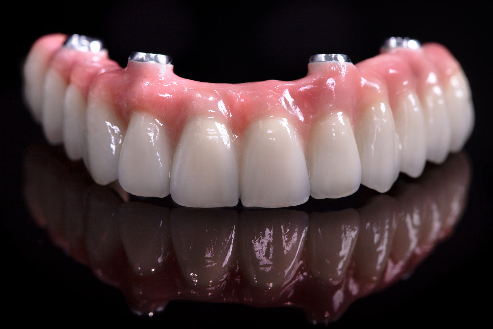 découvrez les options d'implants et prothèses dentaires à avignon pour retrouver un sourire naturel et confortable. conseils, tarifs et spécialistes locaux.