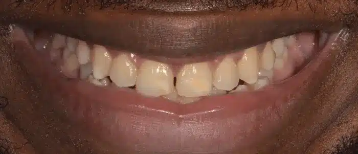 trouvez les meilleurs dentistes spécialisés en blanchiment dentaire à avignon pour un sourire éclatant et éclat de confiance.