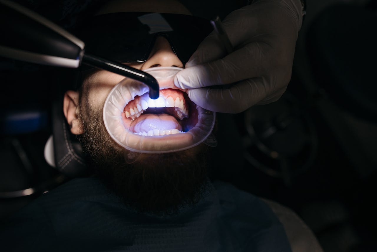 services-04 Close-up of dentist using ultraviolet light on a patient's teeth.