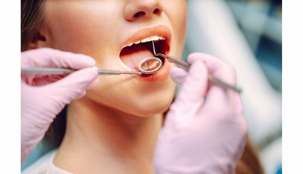 découvrez les solutions efficaces pour le traitement des caries à avignon. soins dentaires professionnels pour préserver votre santé bucco-dentaire.